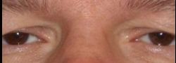 Patient Case #10881 — before