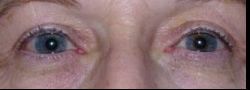 Patient Case #10884 — after