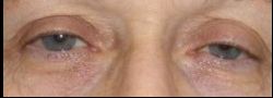 Patient Case #10884 — before
