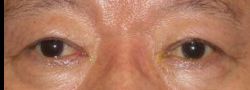 Patient Case #10890 — after