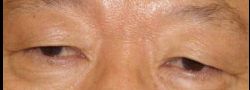 Patient Case #10890 — before