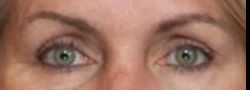 Patient Case #10682 — after