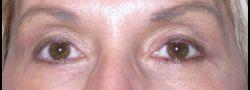 Patient Case #10679 — after