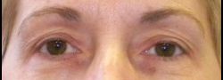 Patient Case #10679 — before