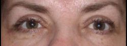 Patient Case #10676 — after