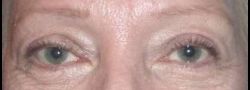 Patient Case #10673 — after