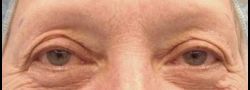 Patient Case #10673 — before
