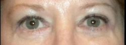 Patient Case #10670 — after