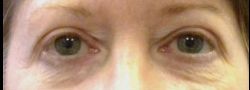 Patient Case #10670 — before