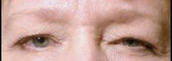 Patient Case #10661 — before
