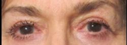 Patient Case #10658 — after