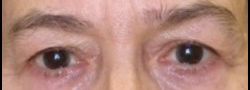 Patient Case #10658 — before