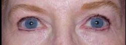 Patient Case #10655 — after