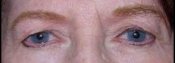 Patient Case #10655 — before