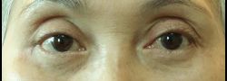 Patient Case #10649 — after