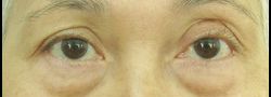 Patient Case #10649 — before