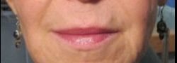 Patient Case #10848 — after