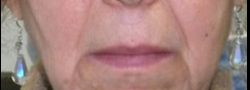 Patient Case #10848 — before