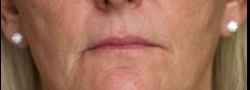 Patient Case #10845 — before