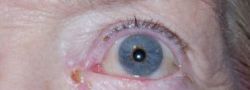 Patient Case #10706 — after