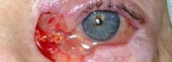 Patient Case #10706 — before