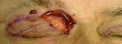 Patient Case #10700 — before
