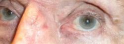 Patient Case #10691 — after