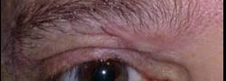 Patient Case #10688 — after
