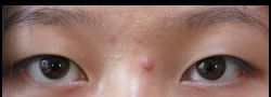 Patient Case #10538 — before