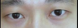 Patient Case #10544 — before