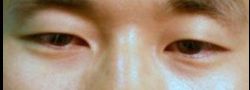 Patient Case #10556 — before