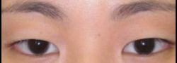Patient Case #10560 — before