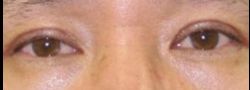 Patient Case #10566 — after