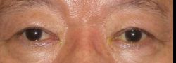 Patient Case #10569 — after