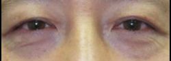 Patient Case #10572 — after