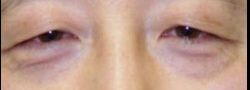 Patient Case #10572 — before
