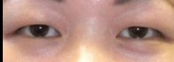 Patient Case #10575 — before