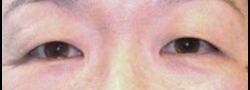 Patient Case #10578 — before