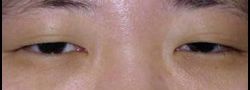 Patient Case #10597 — before