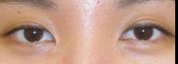 Patient Case #10600 — after