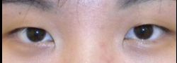 Patient Case #10600 — before