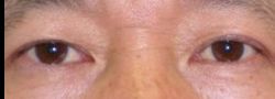 Patient Case #10603 — after