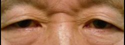 Patient Case #10603 — before