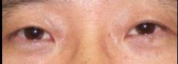 Patient Case #10606 — after
