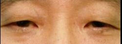 Patient Case #10606 — before