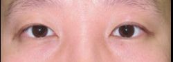 Patient Case #10622 — after