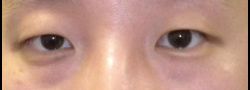Patient Case #10622 — before