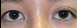 Patient Case #10625 — before