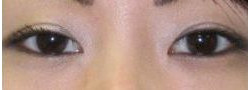 Patient Case #10631 — after