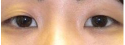 Patient Case #10631 — before